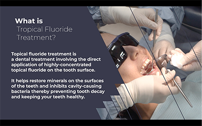 Dental Fluoride Treatment